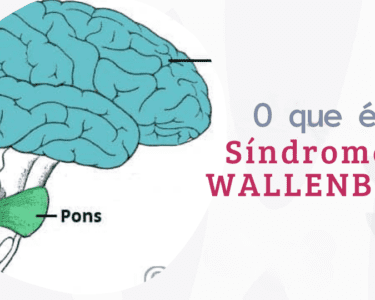 Síndrome de Wallenberg: causas, sintomas e tratamento