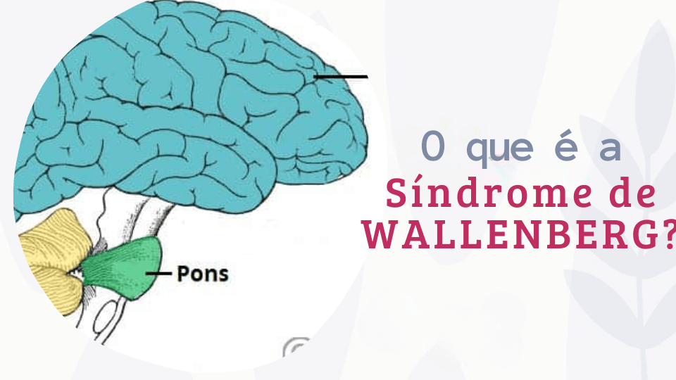 Síndrome de Wallenberg: causas e sintomas